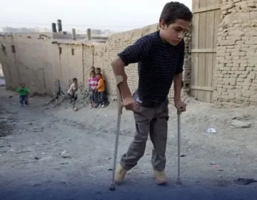 polio case 1