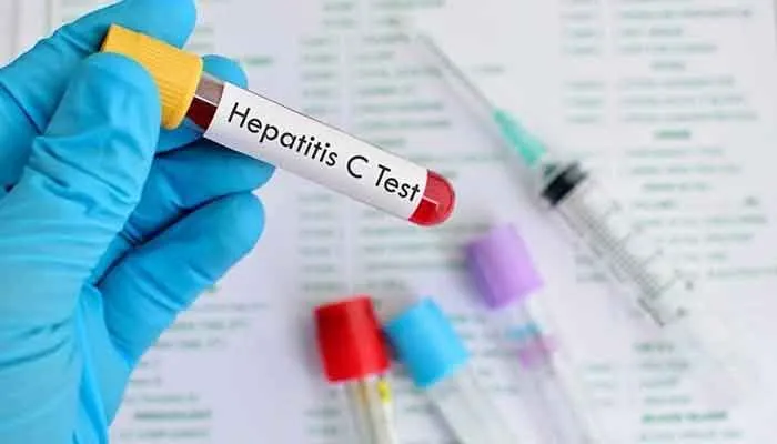 Hepatits C